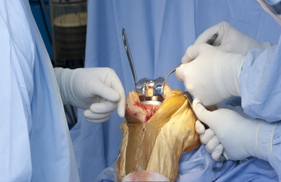 لیست پزشکان فوق تخصص جراحی زانو در کرج