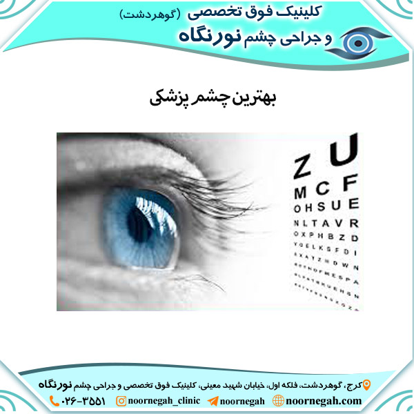 کلینیک چشم پزشکی نورنگاه -